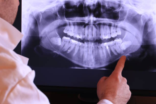 Best Emergency Dentist for Knocked-Out Tooth in Veazie, ME