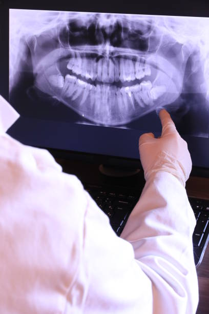 Best Emergency Dental Extractions in Veazie, ME
